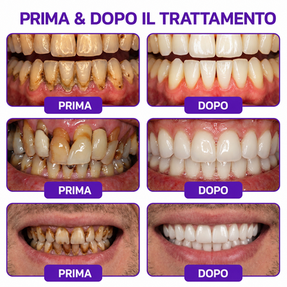 🔑💴GLIMMERLY® VioCore: dentifricio al veleno d'ape per il trattamento della gengivite e della parodontite