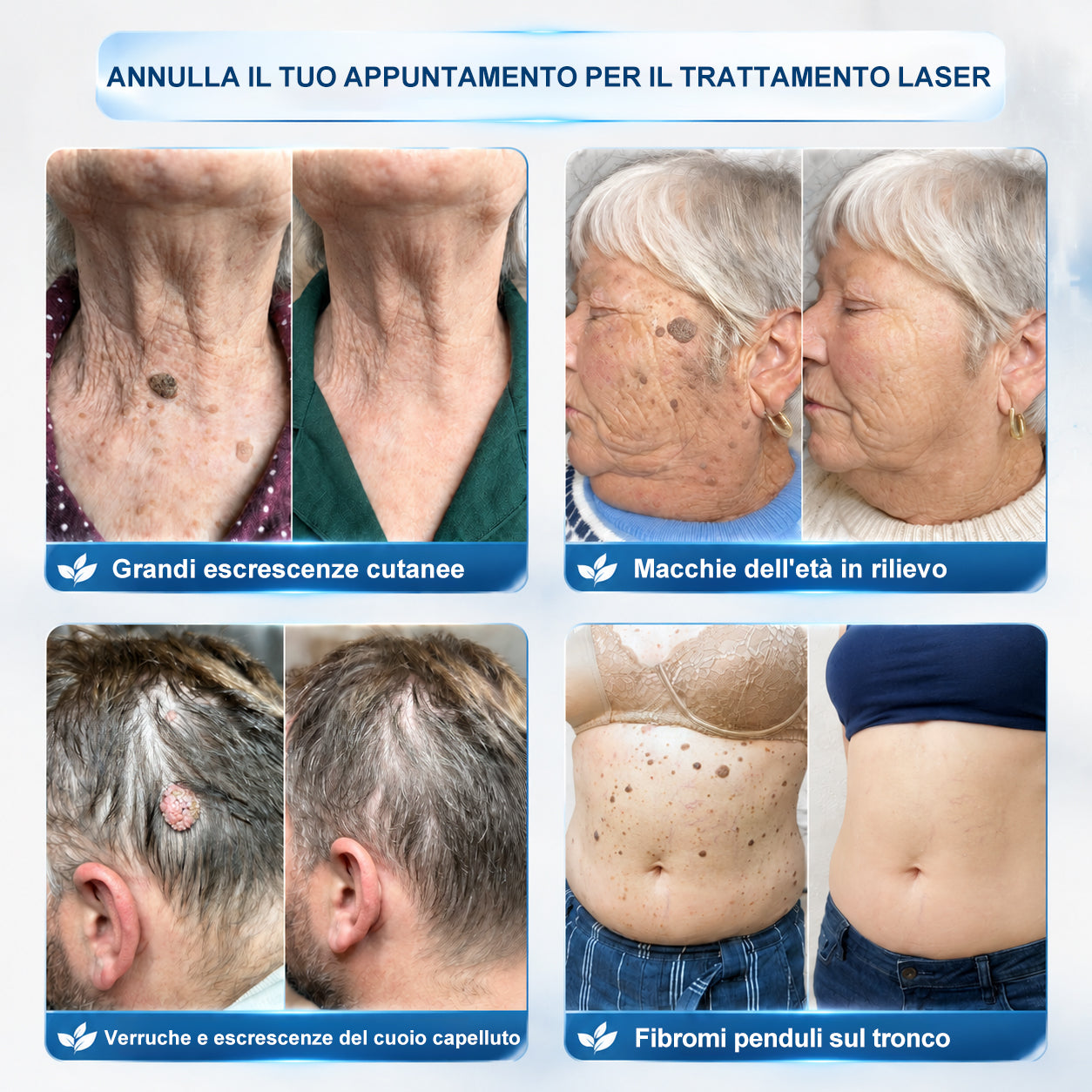 𝐏i𝐜𝐝o® 𝐃𝐢 𝟕 𝐠𝐢𝐨𝐫𝐧𝐢 𝐆𝐨𝐦𝐦𝐚 𝐓𝐚𝐠 & 𝐒𝐩𝐨𝐭(Roll-on Zero Dolore, Zero Cicatrici)💪