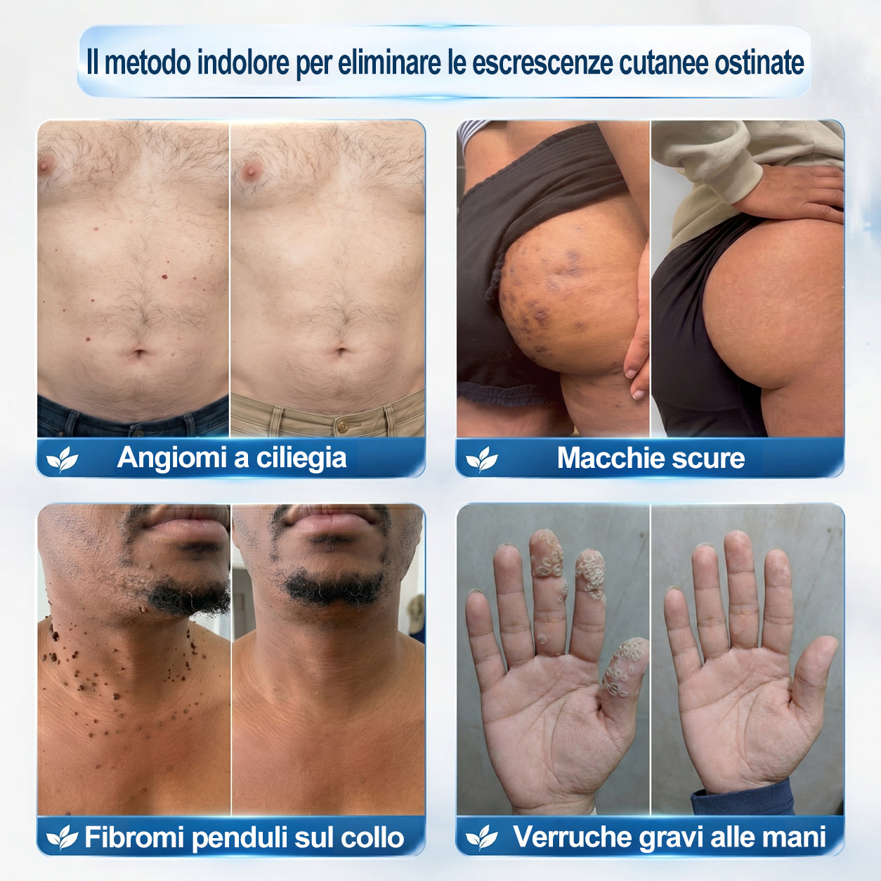 𝐏i𝐜𝐝o® 𝐃𝐢 𝟕 𝐠𝐢𝐨𝐫𝐧𝐢 𝐆𝐨𝐦𝐦𝐚 𝐓𝐚𝐠 & 𝐒𝐩𝐨𝐭(Roll-on Zero Dolore, Zero Cicatrici)💪