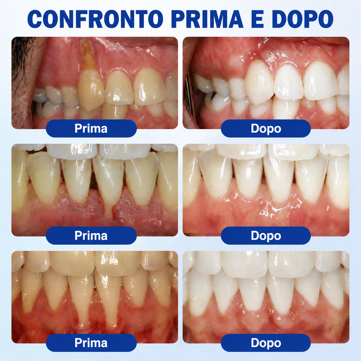 🍬🦸𝑮𝒍𝒊𝒎𝒎𝒆𝒓𝒍𝒚® 𝑮𝒖𝒎𝑹𝒆𝒗𝒊𝒗𝒆 𝑮𝒆𝒍 𝑷𝒂𝒓𝒐𝒅𝒐𝒏𝒕𝒂𝒍𝒆 𝑹𝒊𝒈𝒆𝒏𝒆𝒓𝒂𝒏𝒕𝒆