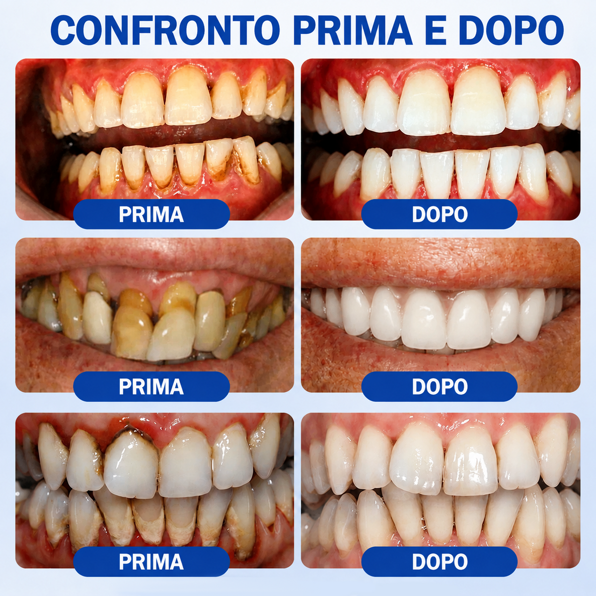 🍬🦸𝑮𝒍𝒊𝒎𝒎𝒆𝒓𝒍𝒚® 𝑮𝒖𝒎𝑹𝒆𝒗𝒊𝒗𝒆 𝑮𝒆𝒍 𝑷𝒂𝒓𝒐𝒅𝒐𝒏𝒕𝒂𝒍𝒆 𝑹𝒊𝒈𝒆𝒏𝒆𝒓𝒂𝒏𝒕𝒆