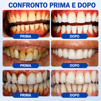 🍬🦸𝑮𝒍𝒊𝒎𝒎𝒆𝒓𝒍𝒚® 𝑮𝒖𝒎𝑹𝒆𝒗𝒊𝒗𝒆 𝑮𝒆𝒍 𝑷𝒂𝒓𝒐𝒅𝒐𝒏𝒕𝒂𝒍𝒆 𝑹𝒊𝒈𝒆𝒏𝒆𝒓𝒂𝒏𝒕𝒆