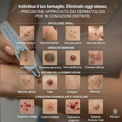 𝐏i𝐜𝐝o® 𝐃𝐢 𝟕 𝐠𝐢𝐨𝐫𝐧𝐢 𝐆𝐨𝐦𝐦𝐚 𝐓𝐚𝐠 & 𝐒𝐩𝐨𝐭(Roll-on Zero Dolore, Zero Cicatrici)💪